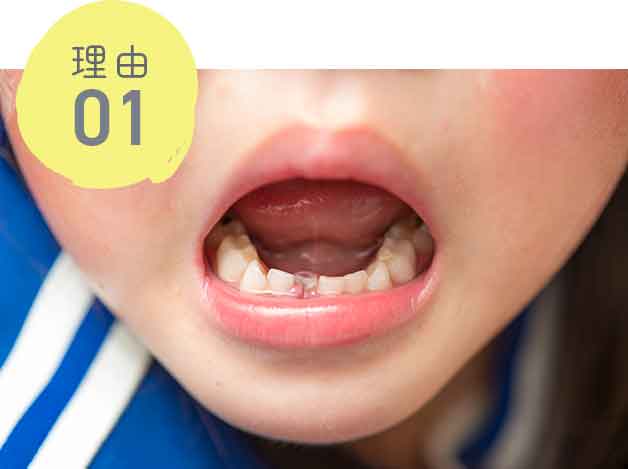 永久歯の歯並び・骨格に影響する