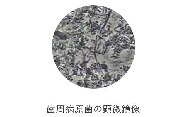 歯周病原菌の顕微鏡像