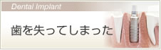 歯を失ってしまった